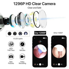 Smart Visual Ear Wax Cleaner With Camera